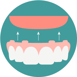 Full & Partial Dentures